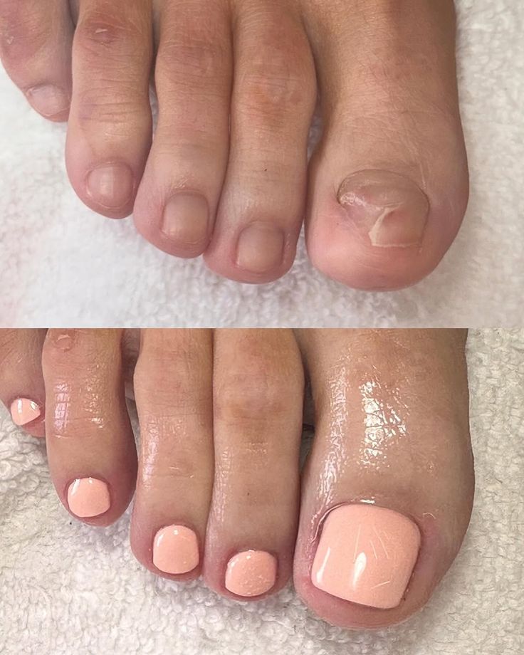 Polish Change - Feet