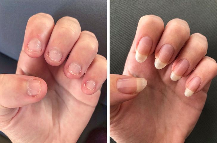 REPAIR & REMOVAL