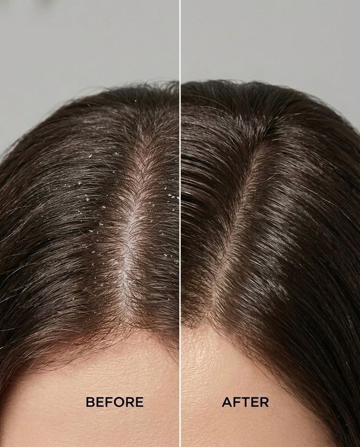 Organic Refresh Scalp Renewal 