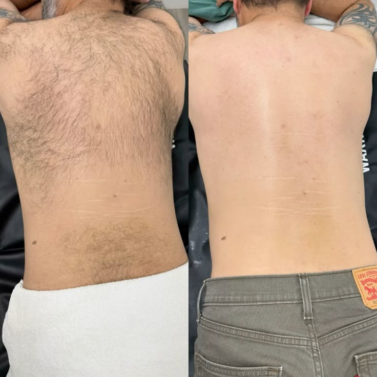 Full Back